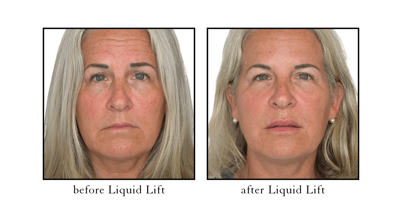 liquid lift liquid lift