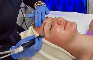Hydrafacial