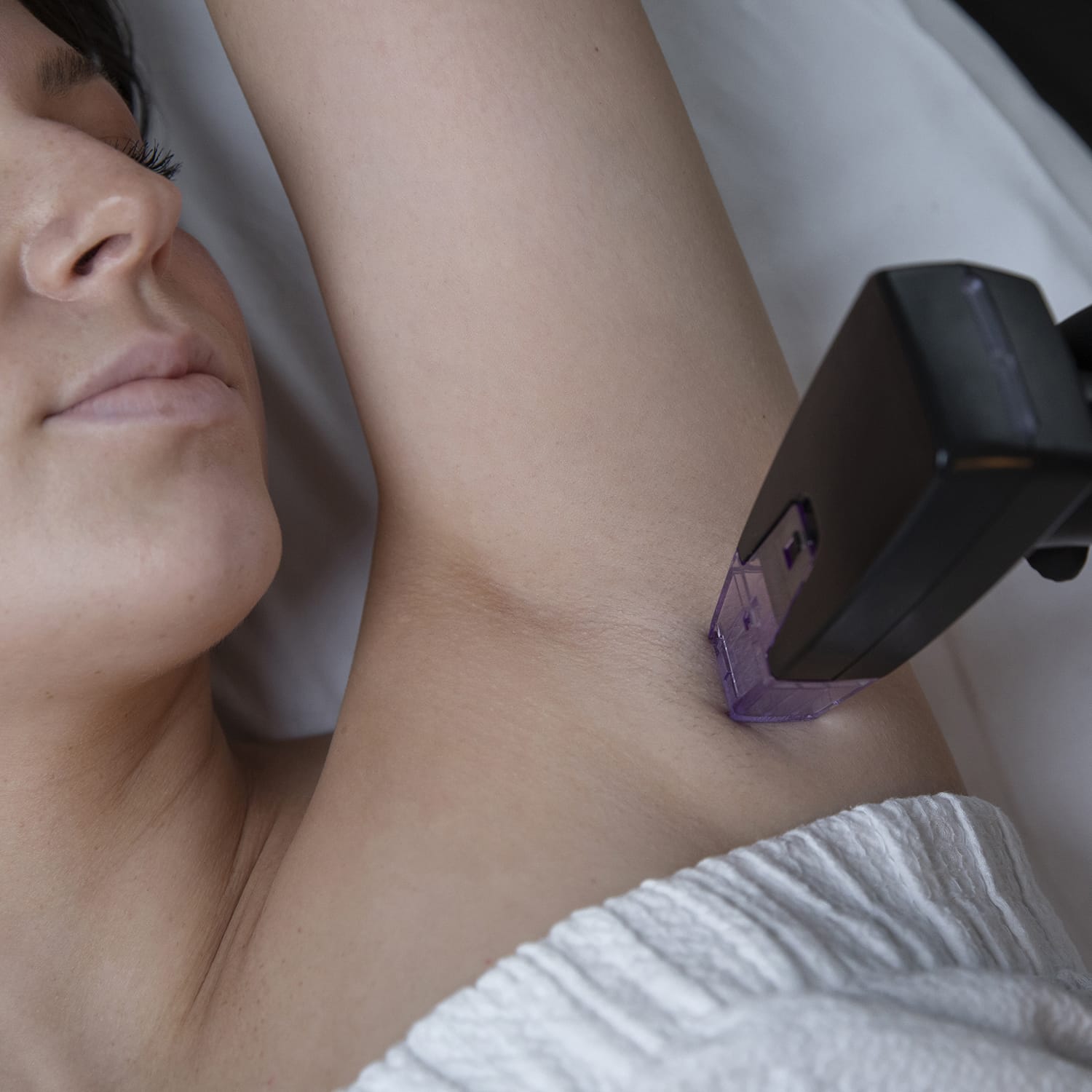 morpheus hyperhidrosis CSLC